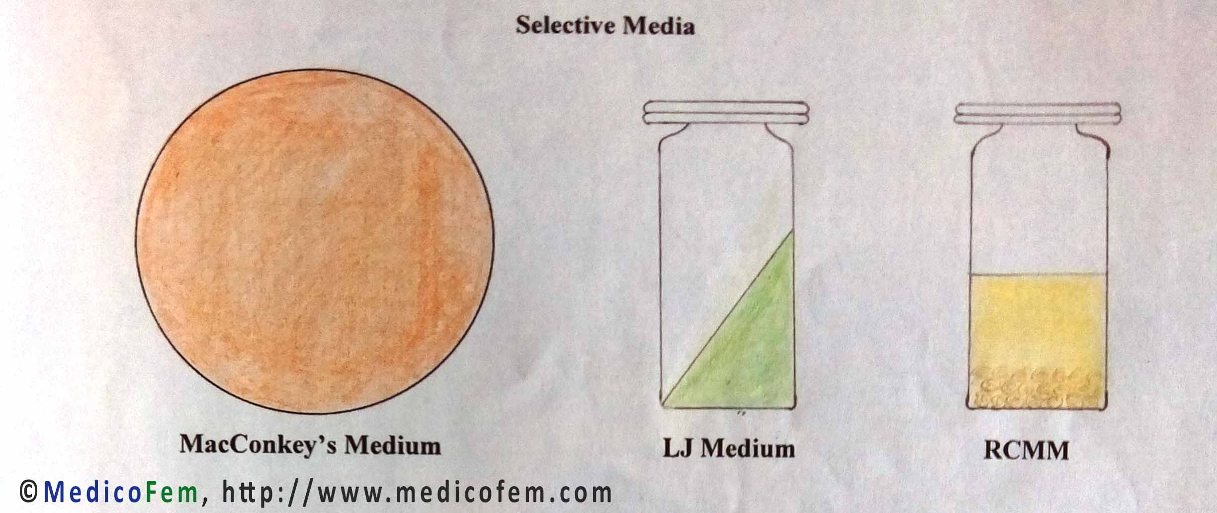 SelectiveMedia